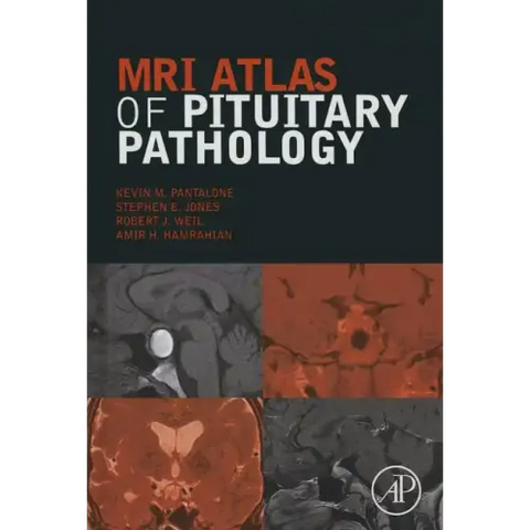 MRI Atlas of Pituitary Pathology