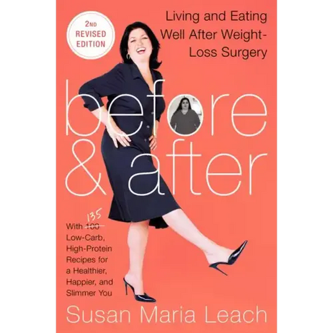 Before & After, Second Revised Edition: Living and Eating Well After Weight-Loss Surgery